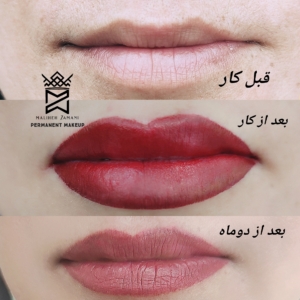 مراحل بهبودی رژ لب دایم